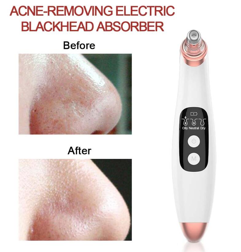 Recore electric vacuum suction blackhead remover with LED display screen