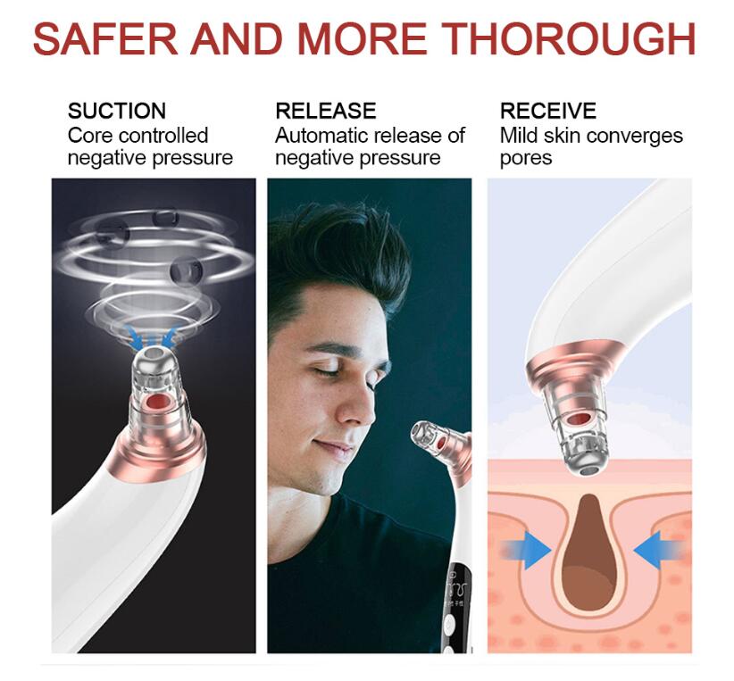 Recore visual pore cleaner removing pimples and deep facial impurities